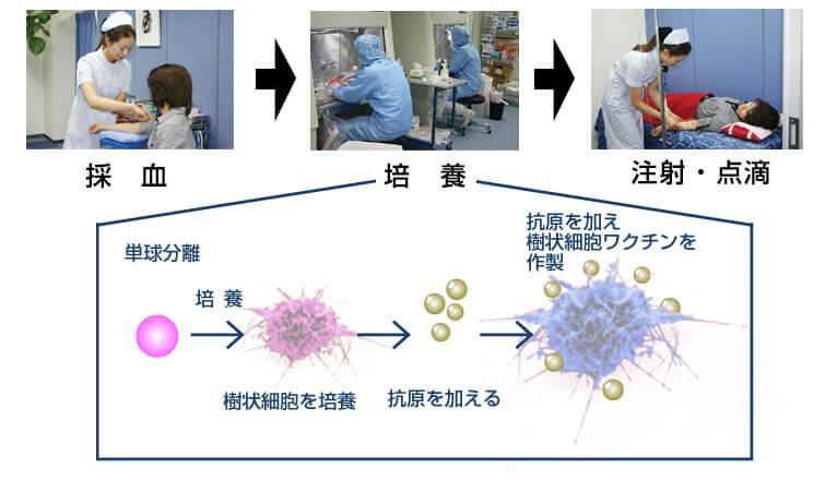 新樹状細胞ワクチン療法の概要